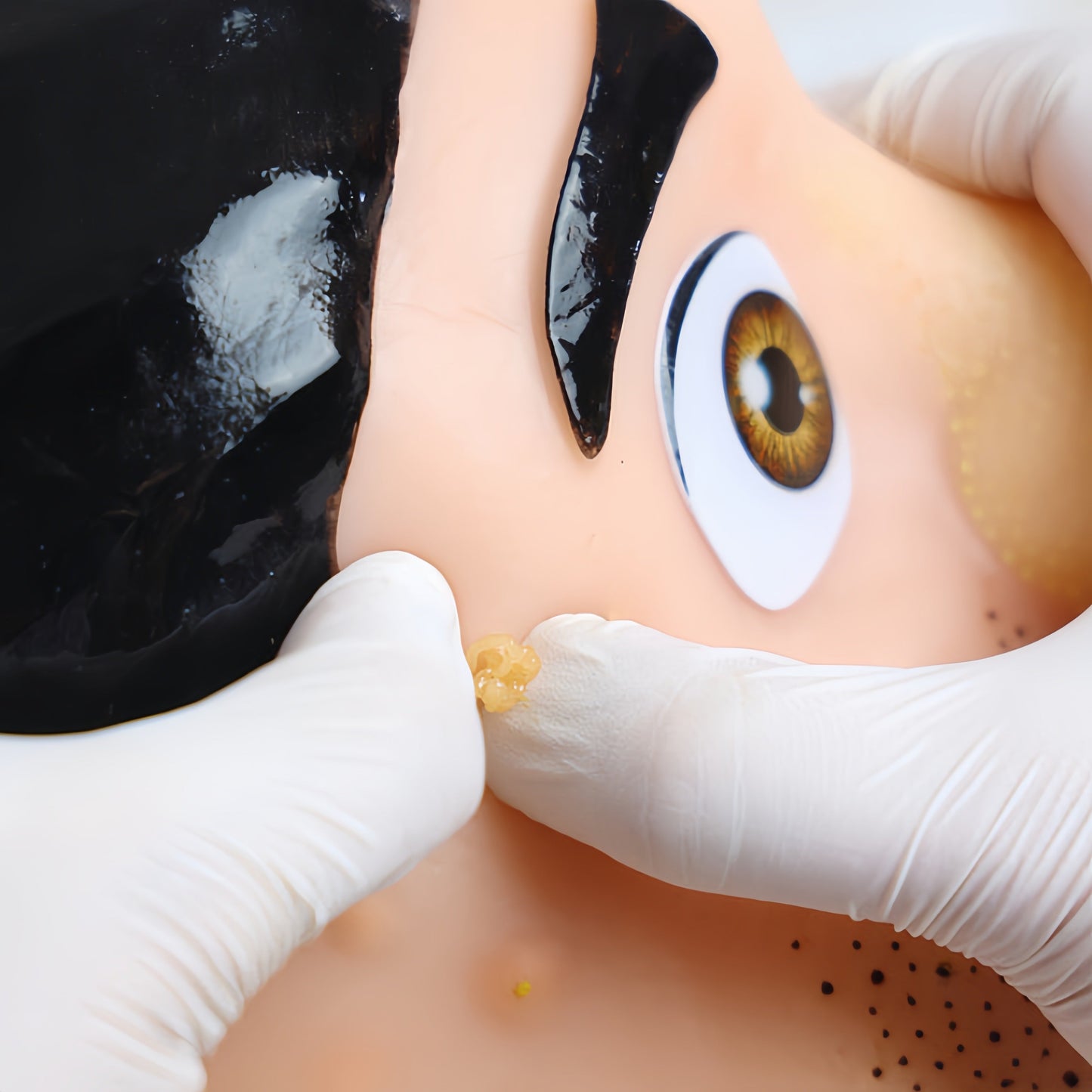 Your Pimple Pal