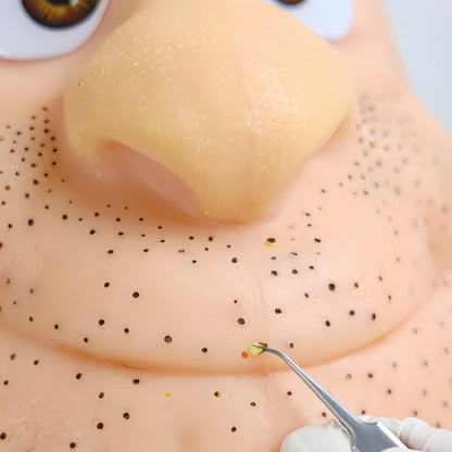 Your Pimple Pal